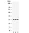 BCL10 Immune Signaling Adaptor antibody, R31853, NSJ Bioreagents, Western Blot image 