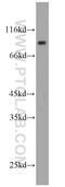 Cold Shock Domain Containing E1 antibody, 13319-1-AP, Proteintech Group, Western Blot image 