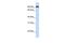 Transmembrane Protein 168 antibody, GTX46011, GeneTex, Western Blot image 