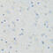 Solute Carrier Family 22 Member 5 antibody, 15-729, ProSci, Immunohistochemistry frozen image 