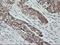 PTPN1 antibody, LS-C797456, Lifespan Biosciences, Immunohistochemistry paraffin image 