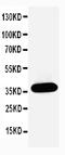 Annexin A4 antibody, PA1007, Boster Biological Technology, Western Blot image 