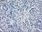 Branched Chain Keto Acid Dehydrogenase Kinase antibody, M07798, Boster Biological Technology, Immunohistochemistry paraffin image 