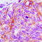 EGFR antibody, LS-C352224, Lifespan Biosciences, Immunohistochemistry frozen image 