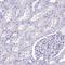 Outer Dense Fiber Of Sperm Tails 3B antibody, HPA062837, Atlas Antibodies, Immunohistochemistry paraffin image 