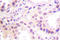 Cullin 2 antibody, LS-C175982, Lifespan Biosciences, Immunohistochemistry paraffin image 