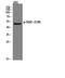 Serum/Glucocorticoid Regulated Kinase 1 antibody, STJ90493, St John