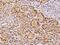 Zinc Finger Protein 140 antibody, 203225-T08, Sino Biological, Immunohistochemistry paraffin image 