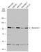 Dynamin 1 antibody, GTX110379, GeneTex, Western Blot image 