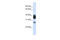Ribonuclease H1 antibody, 25-609, ProSci, Enzyme Linked Immunosorbent Assay image 
