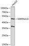 Serpin Family A Member 10 antibody, 19-451, ProSci, Western Blot image 