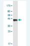 WD Repeat And HMG-Box DNA Binding Protein 1 antibody, H00011169-M01-100ug, Novus Biologicals, Western Blot image 