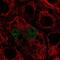 Transcription Factor EC antibody, NBP2-57258, Novus Biologicals, Immunocytochemistry image 