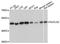 Succinate-CoA Ligase GDP-Forming Beta Subunit antibody, A08268, Boster Biological Technology, Western Blot image 