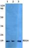 Regenerating Family Member 4 antibody, A04937, Boster Biological Technology, Western Blot image 