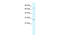 Potassium Voltage-Gated Channel Interacting Protein 1 antibody, 28-259, ProSci, Western Blot image 