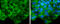 Glypican 3 antibody, GTX130732, GeneTex, Immunofluorescence image 