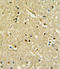 Paired Box 6 antibody, LS-C163394, Lifespan Biosciences, Immunohistochemistry paraffin image 