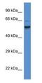 Phosphatidylinositol Glycan Anchor Biosynthesis Class S antibody, NBP1-74155, Novus Biologicals, Western Blot image 