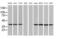 Sterol O-Acyltransferase 2 antibody, MA5-25114, Invitrogen Antibodies, Western Blot image 