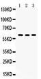 YES Proto-Oncogene 1, Src Family Tyrosine Kinase antibody, PB9466, Boster Biological Technology, Western Blot image 