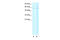 Cholinergic Receptor Nicotinic Alpha 2 Subunit antibody, 31-127, ProSci, Western Blot image 