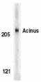 Apoptotic chromatin condensation inducer in the nucleus antibody, NBP1-76855, Novus Biologicals, Western Blot image 