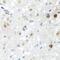 Scaffold Attachment Factor B2 antibody, GTX64864, GeneTex, Immunohistochemistry paraffin image 