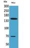 Glycoprotein Ib Platelet Subunit Alpha antibody, STJ96758, St John