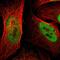 GATA Zinc Finger Domain Containing 2A antibody, PA5-52343, Invitrogen Antibodies, Immunofluorescence image 