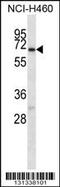 Gamma-Aminobutyric Acid Type A Receptor Alpha4 Subunit antibody, 56-576, ProSci, Western Blot image 