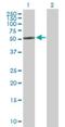 Cytochrome P450 Family 2 Subfamily R Member 1 antibody, H00120227-B01P, Novus Biologicals, Western Blot image 