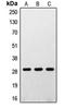 Ribosomal Protein S4 Y-Linked 1 antibody, orb214535, Biorbyt, Western Blot image 