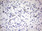 Zinc Finger E-Box Binding Homeobox 1 antibody, M00548-1, Boster Biological Technology, Immunohistochemistry paraffin image 