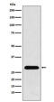 Phosphoglycerate Mutase 1 antibody, M04470-1, Boster Biological Technology, Western Blot image 