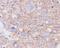 Solute Carrier Family 2 Member 1 antibody, M00163, Boster Biological Technology, Immunohistochemistry frozen image 