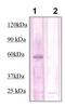 Phosphatase And Tensin Homolog antibody, TA354634, Origene, Western Blot image 