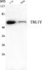 Transducin Beta Like 1 Y-Linked antibody, A14704, Boster Biological Technology, Western Blot image 