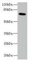 Actin Related Protein 2/3 Complex Subunit 3 antibody, CSB-PA03324A0Rb, Cusabio, Western Blot image 