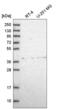 Adenosine Deaminase Like antibody, NBP2-55056, Novus Biologicals, Western Blot image 