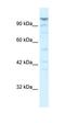 Larp antibody, orb329782, Biorbyt, Western Blot image 