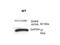 Diacylglycerol Kinase Epsilon antibody, 26-054, ProSci, Western Blot image 