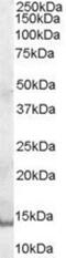 Prolactin Induced Protein antibody, NB100-2923, Novus Biologicals, Western Blot image 