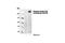 Acetyl-CoA Carboxylase Alpha antibody, 3661L, Cell Signaling Technology, Western Blot image 