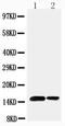 Small Ubiquitin Like Modifier 1 antibody, PA2220, Boster Biological Technology, Western Blot image 