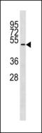 Tubulin Delta 1 antibody, LS-C203859, Lifespan Biosciences, Western Blot image 