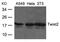 Twist Family BHLH Transcription Factor 2 antibody, 79-768, ProSci, Western Blot image 