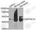 Zinc finger MYND domain-containing protein 10 antibody, A8216, ABclonal Technology, Western Blot image 