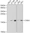 Cytochrome B5 Type A antibody, 19-641, ProSci, Western Blot image 