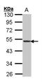 C-X-C Motif Chemokine Receptor 5 antibody, NBP2-16045, Novus Biologicals, Western Blot image 